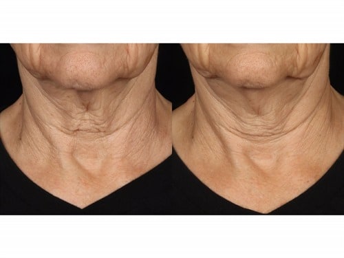 Intensive Nourishing Cream
